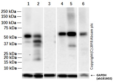 Anti-SOX17 antibody [EPR20684]