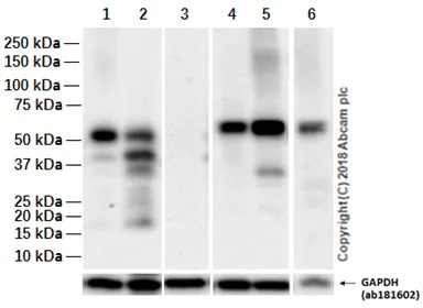 Western blot - Anti-SOX17 antibody [EPR20684] (AB224637)