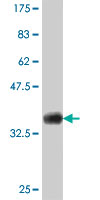 Western blot - Anti-SOX18 antibody (AB66145)