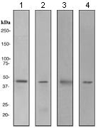 Western blot - Anti-SOX18 antibody [EPR2837(2)] (AB109194), expandable thumbnail