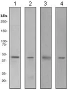 Western blot - Anti-SOX18 antibody [EPR2837(2)] (AB109194)