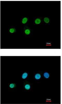 Immunocytochemistry/ Immunofluorescence - Anti-SOX2 antibody (ab137385), expandable thumbnail