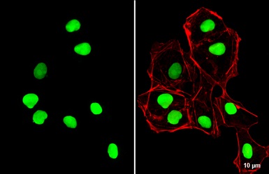 Immunocytochemistry/ Immunofluorescence - Anti-SOX2 antibody (ab137385), expandable thumbnail