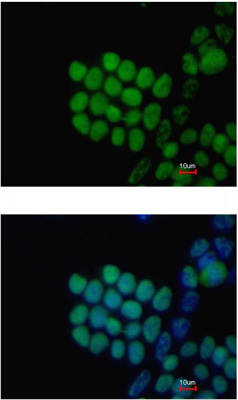 Immunocytochemistry/ Immunofluorescence - Anti-SOX2 antibody (ab137385), expandable thumbnail