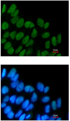 Immunocytochemistry/ Immunofluorescence - Anti-SOX2 antibody (AB137385), expandable thumbnail