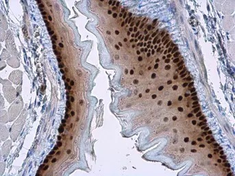 Immunohistochemistry (Formalin/PFA-fixed paraffin-embedded sections) - Anti-SOX2 antibody (ab137385), expandable thumbnail
