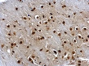 Immunohistochemistry (Formalin/PFA-fixed paraffin-embedded sections) - Anti-SOX2 antibody (ab137385), expandable thumbnail