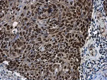 Immunohistochemistry (Formalin/PFA-fixed paraffin-embedded sections) - Anti-SOX2 antibody (AB137385)