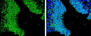 Immunohistochemistry (Formalin/PFA-fixed paraffin-embedded sections) - Anti-SOX2 antibody (ab137385), expandable thumbnail