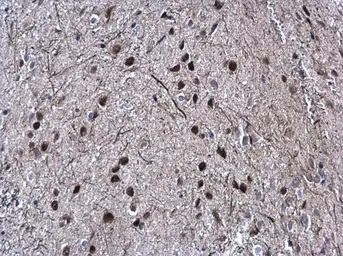 Immunohistochemistry (Formalin/PFA-fixed paraffin-embedded sections) - Anti-SOX2 antibody (ab137385), expandable thumbnail