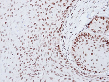 Immunohistochemistry (Formalin/PFA-fixed paraffin-embedded sections) - Anti-SOX2 antibody (AB137385), expandable thumbnail