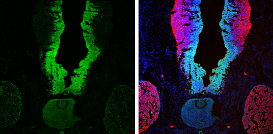 Immunohistochemistry (Frozen sections) - Anti-SOX2 antibody (ab137385), expandable thumbnail
