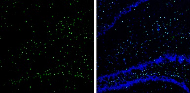 Immunohistochemistry (Frozen sections) - Anti-SOX2 antibody (ab137385), expandable thumbnail