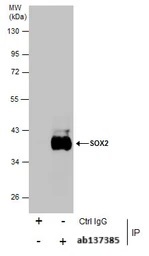 Immunoprecipitation - Anti-SOX2 antibody (ab137385), expandable thumbnail