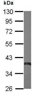 Western blot - Anti-SOX2 antibody (AB137385), expandable thumbnail