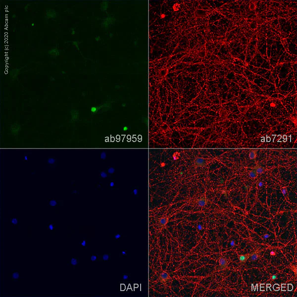 Immunocytochemistry/ Immunofluorescence - Anti-SOX2 antibody (AB97959)