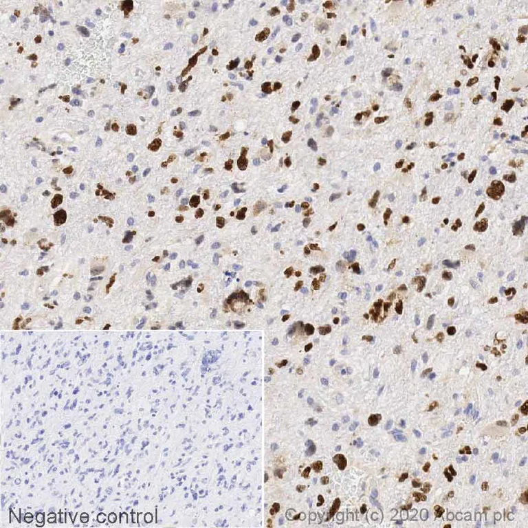 Immunohistochemistry (Formalin/PFA-fixed paraffin-embedded sections) - Anti-SOX2 antibody (AB97959)