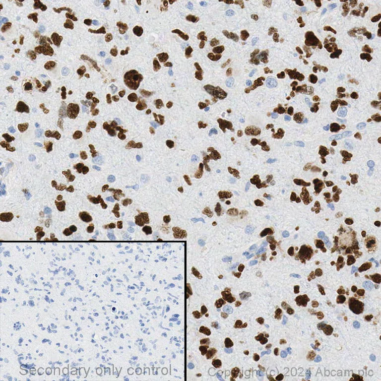 Immunohistochemistry (Formalin/PFA-fixed paraffin-embedded sections) - Anti-SOX2 antibody [EPR3131] (AB92494)
