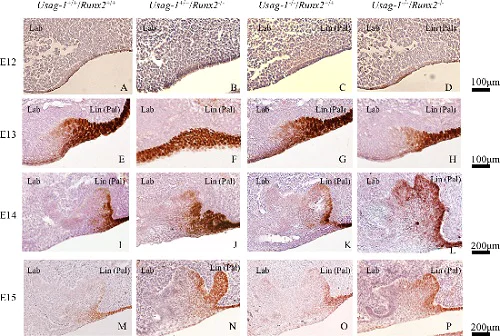 Immunohistochemistry (Formalin/PFA-fixed paraffin-embedded sections) - Anti-SOX2 antibody [EPR3131] (AB92494)
