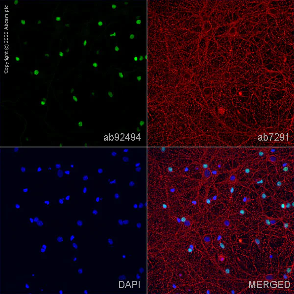 Immunocytochemistry/ Immunofluorescence - Anti-SOX2 antibody [EPR3131] - BSA and Azide free (AB215970)