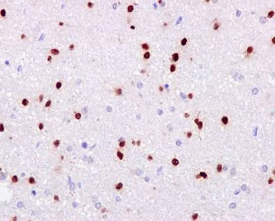 Immunohistochemistry (Formalin/PFA-fixed paraffin-embedded sections) - Anti-SOX2 antibody [EPR3131] - BSA and Azide free (AB215970)