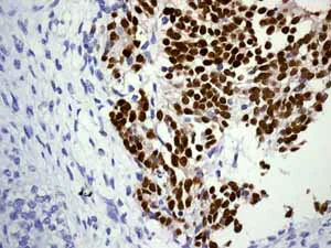 Immunohistochemistry (Formalin/PFA-fixed paraffin-embedded sections) - Anti-SOX2 antibody [EPR3131] - BSA and Azide free (AB215970)