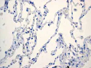 Immunohistochemistry (Formalin/PFA-fixed paraffin-embedded sections) - Anti-SOX2 antibody [EPR3131] - BSA and Azide free (AB215970)