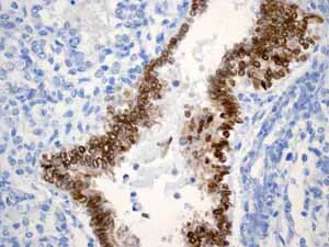 Immunohistochemistry (Formalin/PFA-fixed paraffin-embedded sections) - Anti-SOX2 antibody [EPR3131] - BSA and Azide free (AB215970)