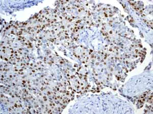 Immunohistochemistry (Formalin/PFA-fixed paraffin-embedded sections) - Anti-SOX2 antibody [EPR3131] - BSA and Azide free (AB215970)