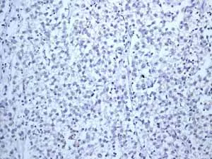 Immunohistochemistry (Formalin/PFA-fixed paraffin-embedded sections) - Anti-SOX2 antibody [EPR3131] - BSA and Azide free (AB215970)