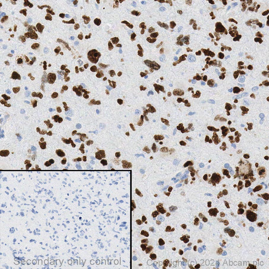 Immunohistochemistry (Formalin/PFA-fixed paraffin-embedded sections) - Anti-SOX2 antibody [EPR3131] - BSA and Azide free (AB215970)