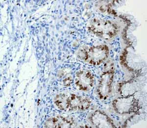 Immunohistochemistry (Formalin/PFA-fixed paraffin-embedded sections) - Anti-SOX2 antibody [EPR3131] - BSA and Azide free (AB215970)