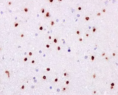 Immunohistochemistry (Formalin/PFA-fixed paraffin-embedded sections) - Anti-SOX2 antibody [EPR3131] - BSA and Azide free (AB215970)