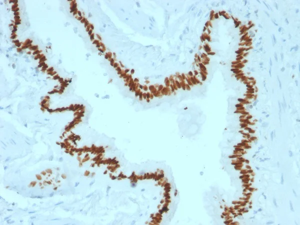 Immunohistochemistry (Formalin/PFA-fixed paraffin-embedded sections) - Anti-SOX2 antibody [SOX2/1791] (AB218520)