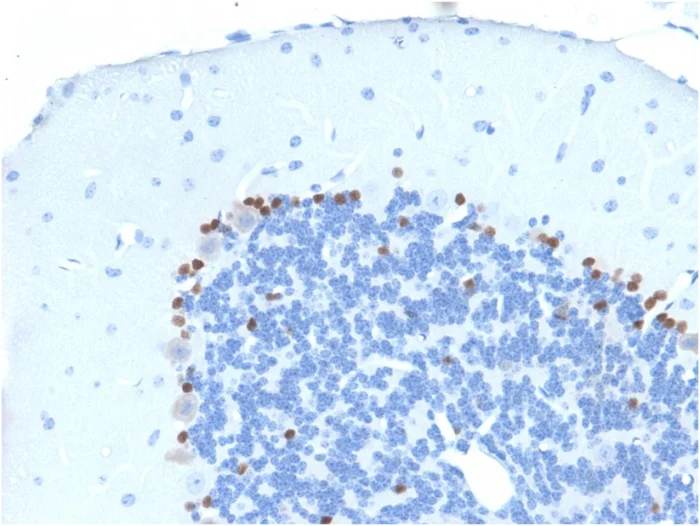 Immunohistochemistry (Formalin/PFA-fixed paraffin-embedded sections) - Anti-SOX2 antibody [SOX2/1791] (AB218520)