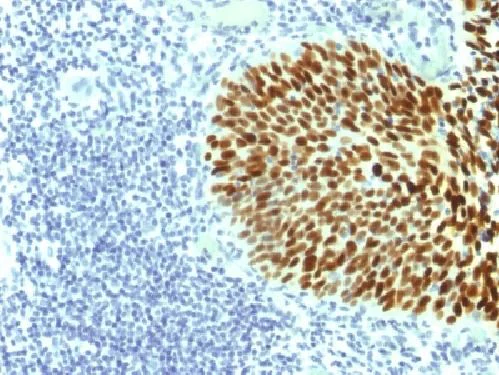 Immunohistochemistry (Formalin/PFA-fixed paraffin-embedded sections) - Anti-SOX2 antibody [SOX2/1791] (AB218520)