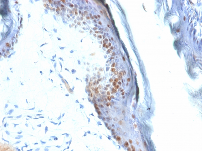 Immunohistochemistry (Formalin/PFA-fixed paraffin-embedded sections) - Anti-SOX2 antibody [SOX2/1792] (AB218521), expandable thumbnail