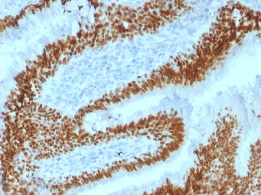 Immunohistochemistry (Formalin/PFA-fixed paraffin-embedded sections) - Anti-SOX2 antibody [SOX2/1792] (AB218521)