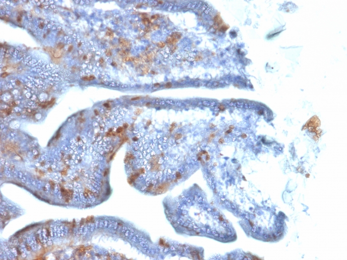 Immunohistochemistry (Formalin/PFA-fixed paraffin-embedded sections) - Anti-SOX2 antibody [SOX2/1792] (AB218521), expandable thumbnail