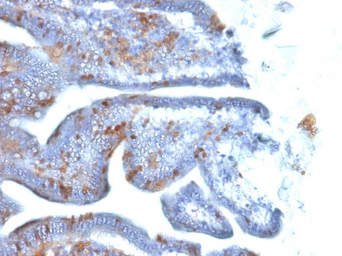 Immunohistochemistry (Formalin/PFA-fixed paraffin-embedded sections) - Anti-SOX2 antibody [SOX2/1792] (AB218521)