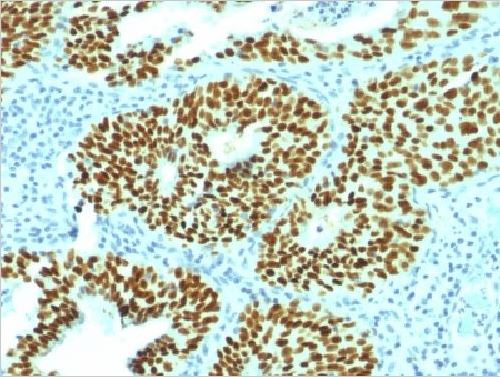 Immunohistochemistry (Formalin/PFA-fixed paraffin-embedded sections) - Anti-SOX2 antibody [SOX2/1792] (AB218521), expandable thumbnail