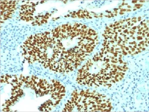 Immunohistochemistry (Formalin/PFA-fixed paraffin-embedded sections) - Anti-SOX2 antibody [SOX2/1792] (AB218521)