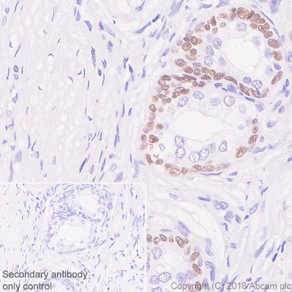 Immunohistochemistry (Formalin/PFA-fixed paraffin-embedded sections) - Anti-SOX2 antibody [SP76] (AB93689)