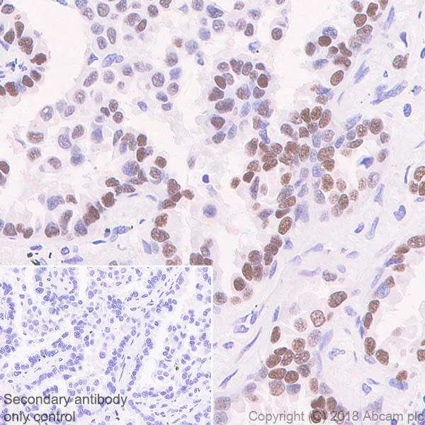 Immunohistochemistry (Formalin/PFA-fixed paraffin-embedded sections) - Anti-SOX2 antibody [SP76] (AB93689)