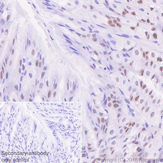 Immunohistochemistry (Formalin/PFA-fixed paraffin-embedded sections) - Anti-SOX2 antibody [SP76] (AB93689)