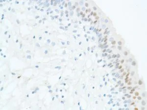 Immunohistochemistry (Formalin/PFA-fixed paraffin-embedded sections) - Anti-SOX2 antibody [SP76] - N-terminal, prediluted (AB101547)