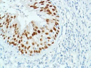 Immunohistochemistry (Formalin/PFA-fixed paraffin-embedded sections) - Anti-SOX2 antibody [SP76] - N-terminal, prediluted (AB101547)