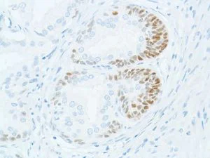 Immunohistochemistry (Formalin/PFA-fixed paraffin-embedded sections) - Anti-SOX2 antibody [SP76] - N-terminal, prediluted (AB101547)