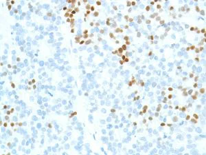 Immunohistochemistry (Formalin/PFA-fixed paraffin-embedded sections) - Anti-SOX2 antibody [SP76] - N-terminal, prediluted (AB101547)