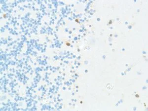 Immunohistochemistry (Formalin/PFA-fixed paraffin-embedded sections) - Anti-SOX2 antibody [SP76] - N-terminal, prediluted (AB101547)